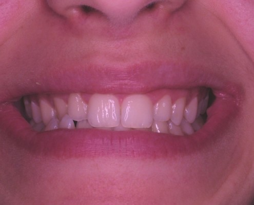 ac1-sorriso